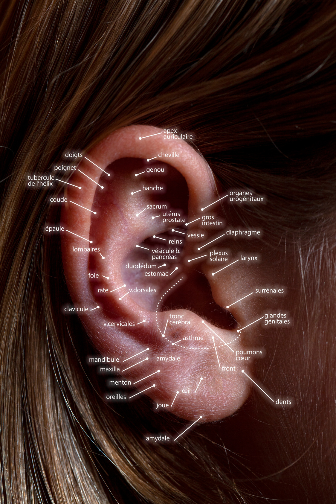 Auriculotherapy