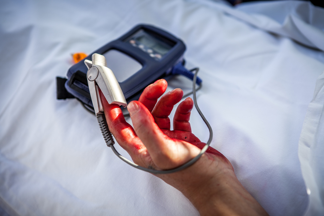 Medical emergency team: pulse oximetry