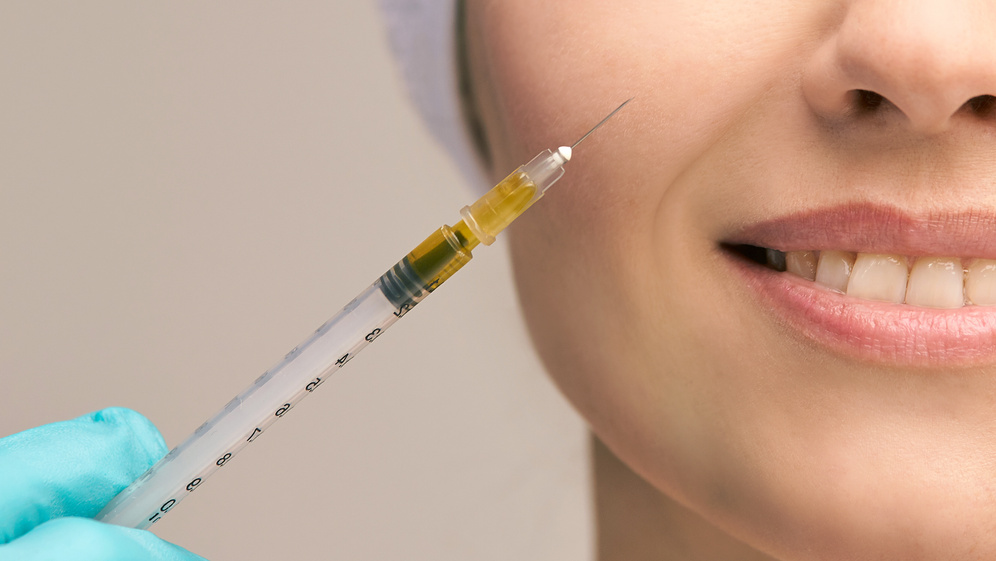 Close-up of Face with Prp Rich Plasma Injection
